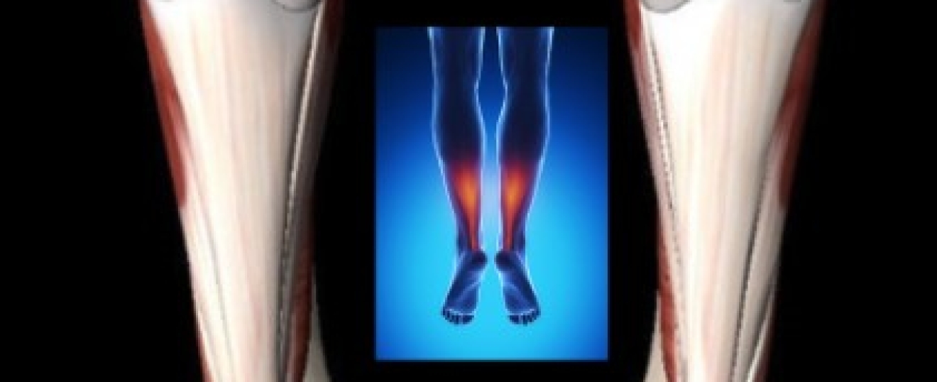 Calf Start-up Pain